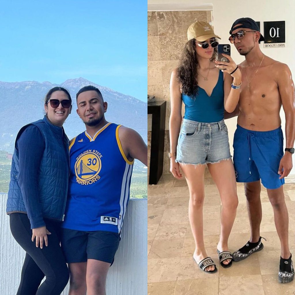 Gastric Sleeve Before and After Result - Dr. Gabriela Rodriguez Gastric Sleeve Before and After Result - Dr. Gabriela Rodriguez