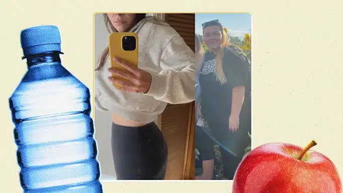 single incision gastric sleeve Tijuana